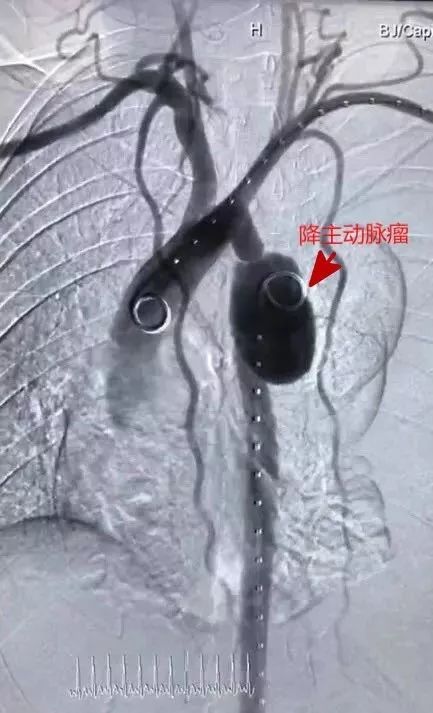 (高处坠落解释)不幸累倒的侠客!高处坠落险象环生,命悬一线 (高处坠落解释)不幸累倒的侠客!高处坠落险象环生,命悬一线